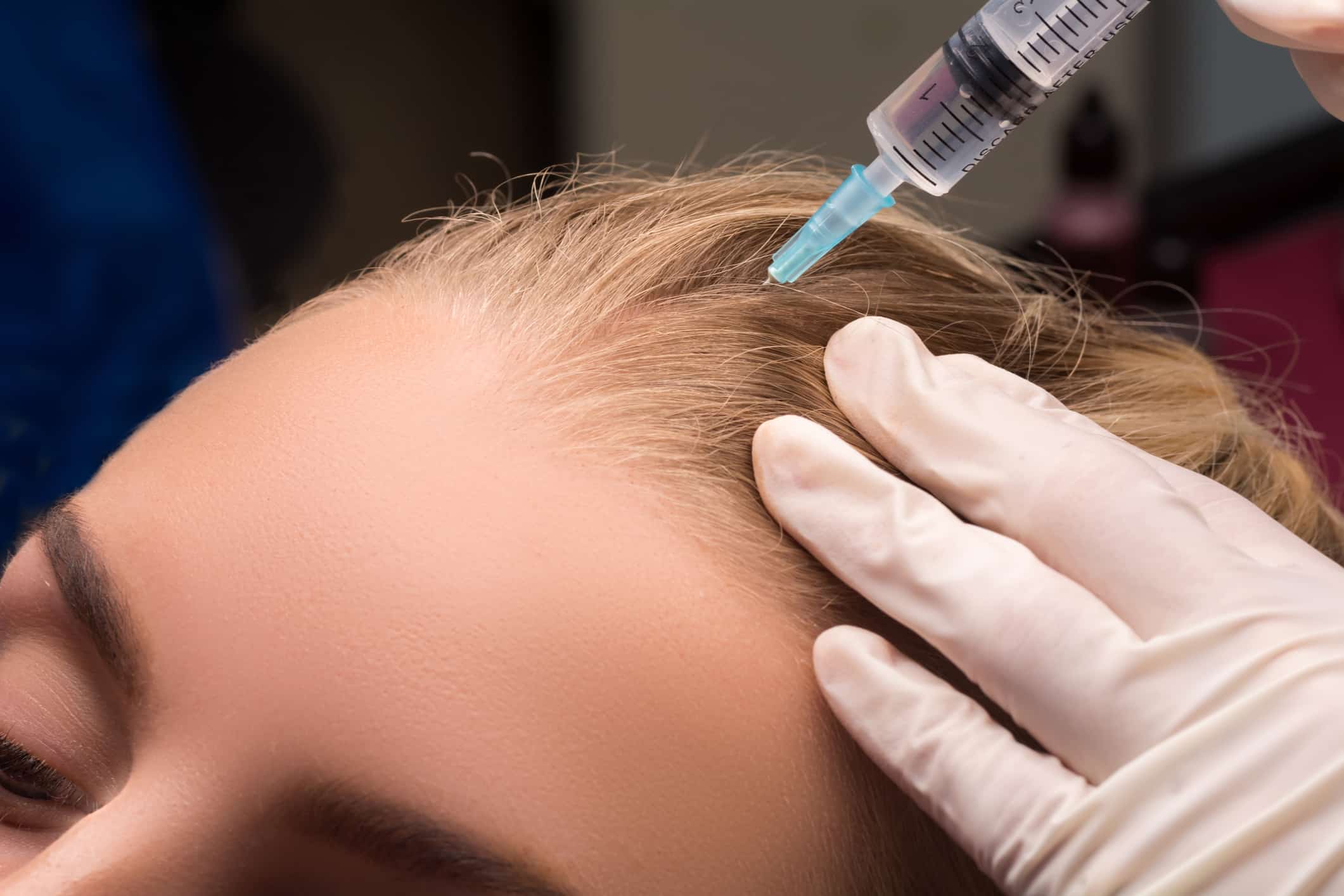 Meso­therapie